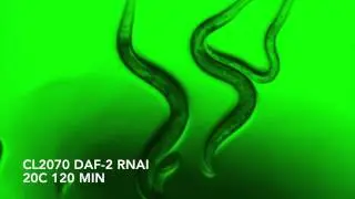 GFP in Caenorhabditis elegans & Fluorescent microscope images