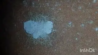 Microfilaria parasitic movement