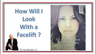 How Will I look With a Facelift?