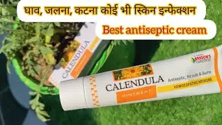 Cream that heals burns and cuts fastest. Calendula ointment uses in Hindi |