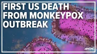 Monkeypox death confirmed by LA County health officials