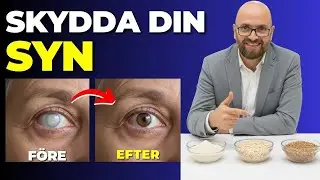 Efter 50: 5 Livsmedel som Skyddar Din Synnerv (Nr 2 Bromsar Synförlust)