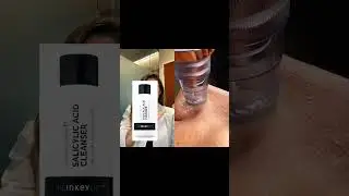 Derm-Approved #SkincareRoutine for Clear Pores #fok #derm #ad