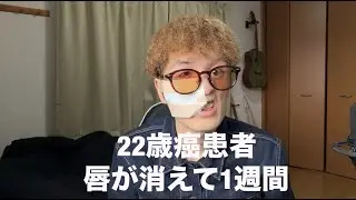 唇が消えて1週間