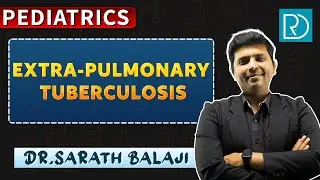Extra-Pulmonary Tuberculosis Simplified | Clinical Approach & Key Points
