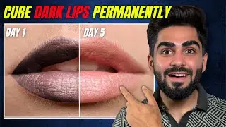 5 Days Challenge to Cure Dark Lips Naturally | Get Pink & Soft Lips Fast !!