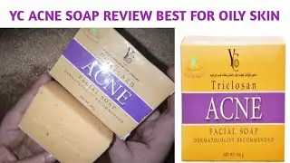 YC Acne triclosan soap review | Facial soap