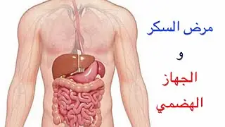 تأثير مرض السكر على الجهاز الهضمي