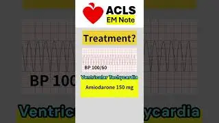 ACLS Rhyrhm Test #acls