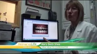 Mountain Dew Teeth - Wednesday, January 21, 2015