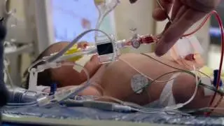 Medicina para todos: efectos del embarazo de alto riesgo en niños