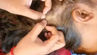 Lice Check & Tangle Removal ASMR - The Ultimate Relaxation Experience