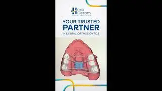 Hexa Ceram  - Your Trusted  Partner in Digital Orthodontics