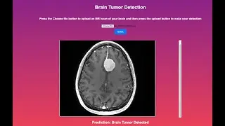 Brain Tumor Detection