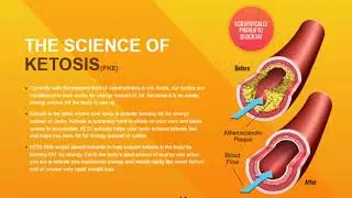 Keto Advanced Diet Reviews| Weight Loss Supplement | Keto Advanced Ingredients