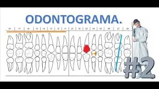 Como llenar un Odontograma | Parte 2.