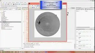 ANALYSIS OF RETINAL BLOOD VESSELS USING IMAGE PROCESSING TECHNIQUES