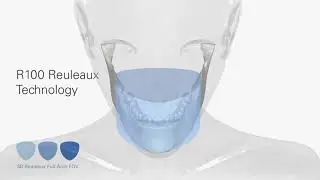 Veraviewepocs 3D R100 - Alta Resolu&ccedil;&atilde;o