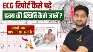 ECG Report Kaise Padhe | ECG Test Full Explanation in Hindi | Testpaperlive Nursing Classes
