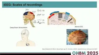 OHBM 2025 | Symposium | Saurabh Sonkusare | Leveraging movies to understand brain-body interaction&hellip;