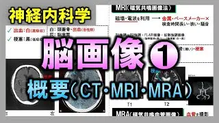 【脳画像①】概要（CT・MRI・MRA）【理学療法士・作業療法士】