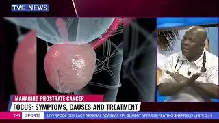 In-depth Medical Consultant Analysis of Prostrate Cancer Symptoms, Causes, and Treatment