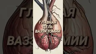 Главная цель вазэктомии #доктор #врач #уролог #каримов #аденома #простата #вазэктомия