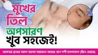 মুখে ফ্রেকলস: তিল, ব্রণ থাকলে কি অসুবিধা হয়? জেনে নিন কারণ ও চিকিৎসা | Freckles Problem Solutions