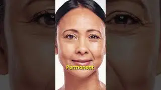 ⏳ The Botox Timeline: From Expression Lines to Permanent Wrinkles | Preventive Botox Explained!