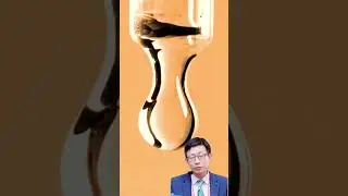 Enhanced Efficacy and Safety: Platelet-Rich Plasma + Hyaluronic  Acid for Knee Osteoarthritis