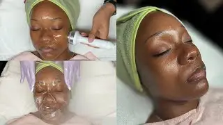 Deep Hydrating Facial | Advanced Ultrasound Therapy