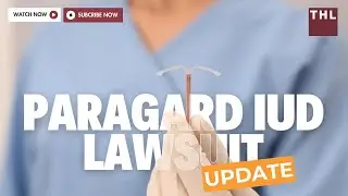 [June 2023] Paragard IUD Lawsuit Update | Paragard IUD Lawsuit Overview