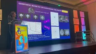 PROSTATE MRI-New Technology for Superior Cancer Detection-Invited Speaker, PRUA 2025 Annual Meeting 