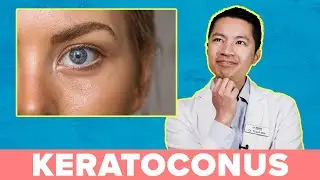 Will I Go Blind If I Have Keratoconus?