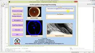 Iris Recognition Using Matlab Project Code