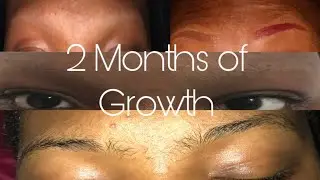 Shaved My Eyebrows Off(2 Months of Growth)
