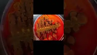 Lytic colonies of  Pseudomonas aeruginosa grows on blood agar after overnight incubation. #shorts