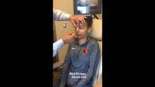 Rhinoplasty Reveal - Dr. Portuese Removes Cast After Nose Surgery - Seattle, Portland, Ketchum