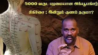 5000 வருட பழமையான அக்யூபங்சர் சிகிச்சை | இன்றும் குணம் தருமா?