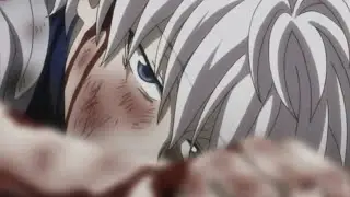 Sad Killua edit.Suicide moment