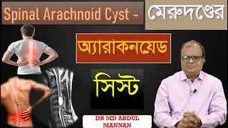 মেরুদণ্ডের অ্যারাকনয়েড সিস্ট - Spinal Arachnoid Cyst - হোমিওপ্যাথিক চিকিৎসা - Dr. Abdul Mannan