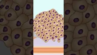 Cancer Development: Unveiling the Hidden Truths (Must Watch!)