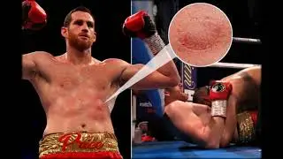 Bite-shame boxer Kash Ali punished over bizarre David Price attacks