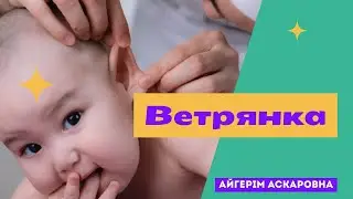 Зеленка Жақпаймыз / Ветрянка кезінде не істеу керек?
