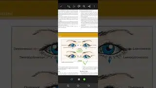 Versions and vergences