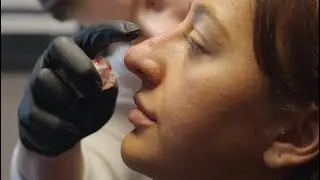 Avatar Nase? 👀 nicht bei uns! Nasenkorrektur mit DR. NICK