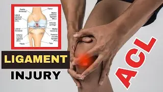 Grade 1 aur Grade 2  ACL Ligament injury me kya Exercises kare | Easy Recovery Tips by Doctor |