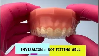Invisalign © Not Fitting Well !