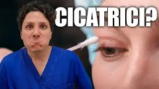 BLEFAROPLASTICA Palpebre: Tutta la Verità sulle CICATRICI