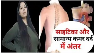 scatica pain or normal back pain mai kya difference hota hai| what is scitica pain#ythealth